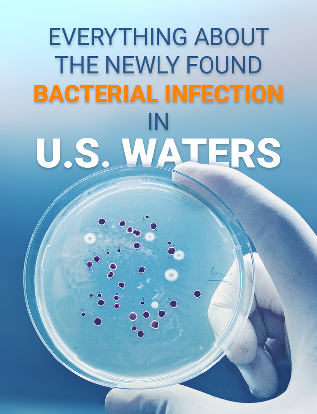 EVERYTHING ABOUT THE NEWLY FOUND BACTERIAL INFECTION IN U.S. WATERS